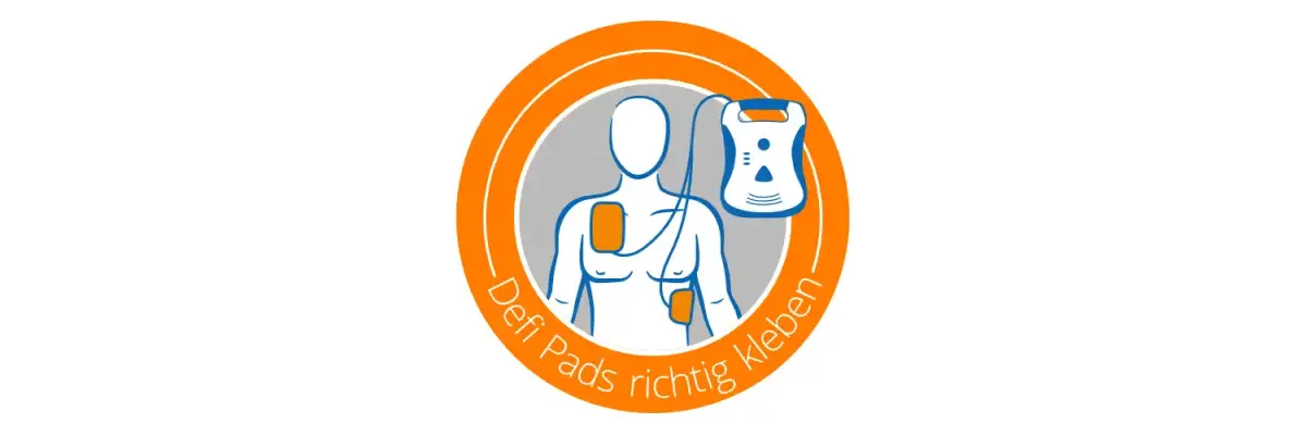 Mit AEDs Leben retten – Wie Sie Defi Pads richtig kleben - Defi Pads kleben - Anleitung &amp;amp; Tipps | medplus-Ratgeber