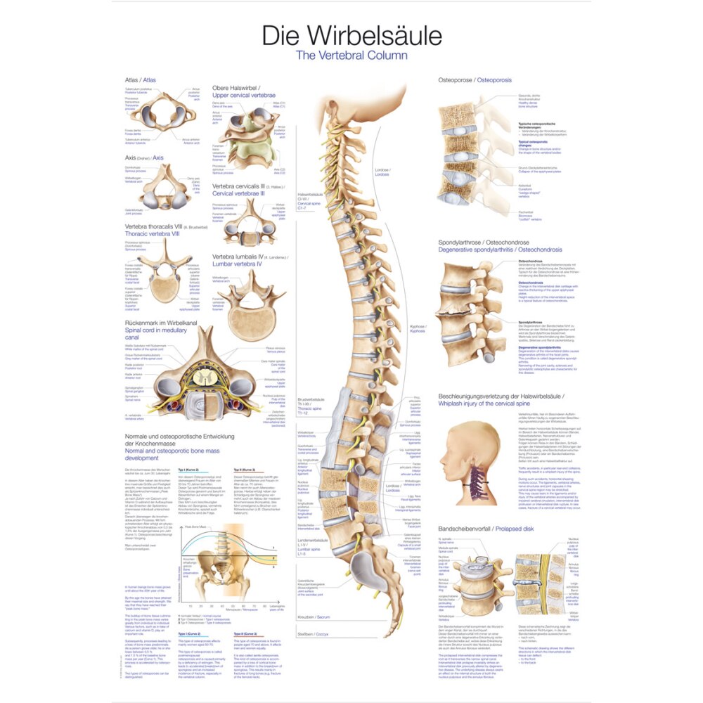 Lehrtafel *Die Wirbelsäule* (AL107) | Medplus24.de